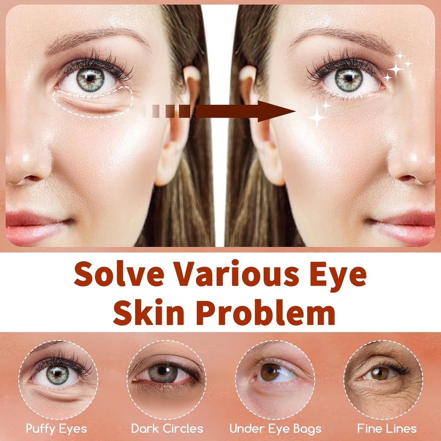 Caffeine Under Eye Masks, 60 Pcs Brightening Eye Patches for Dark Circles and Puffiness with Hyaluronic Acid, Reduce Dark Circles Eye Gel Pad