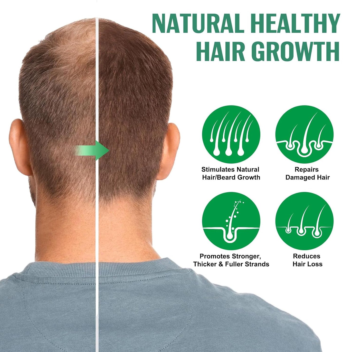 Hair Growth Serum Spray, 2 Pack Natural Hair Growth Spray With Biotin, Batana, Rosemary, and Castor Oil, Caffeine Ginseng Support Scalp Care Treatment, Thinning Hair Regrowth Thickening, Reduce damage