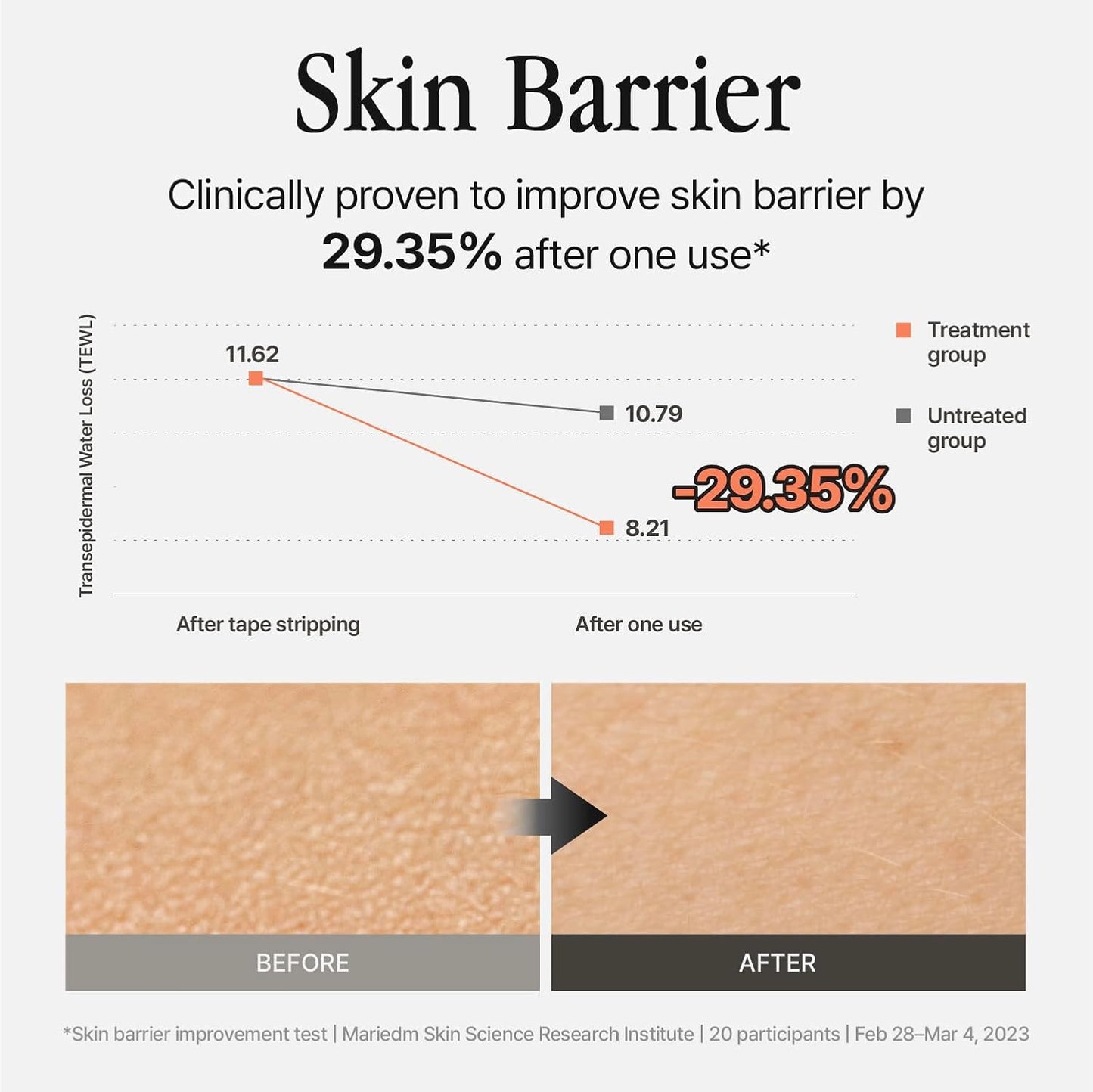 Silver Frost Mist, Refill - Facial Barrier Toner Spray with 80% Witch Hazel Water, Cica for Skin Barrier Repair, Recovery for Sensitive Skin, Dewy Hydration, Korean Skin Care (3.38 fl oz)