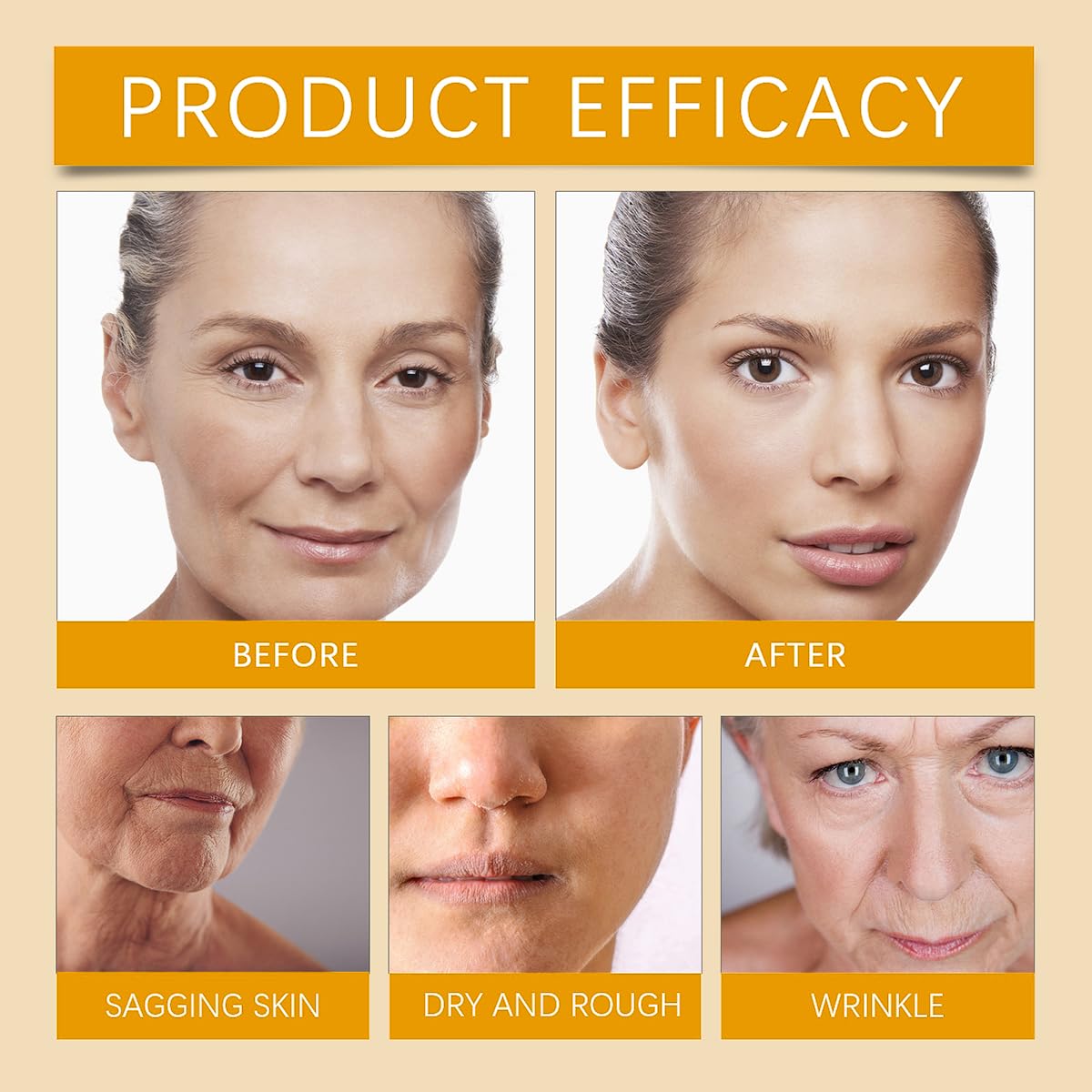 Bee Venom Moisturiser Cream Wrinkle Removal & Firming, Anti-Aging Eye & Face Bee Venom Skin Treatment Cream (1 Pack, 0.71Oz)