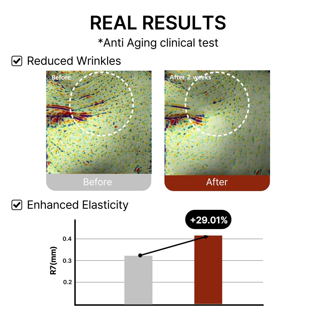 Mito-on Cell Rejuvenation Anti-Aging Serum, 30ml / 1.01 fl.oz –10% Niacinamide, Vitamin B3 and Antioxidants, Centella + EGF for Anti-Aging, Wrinkle Reduction, Pore minimization, Korean Skin Care