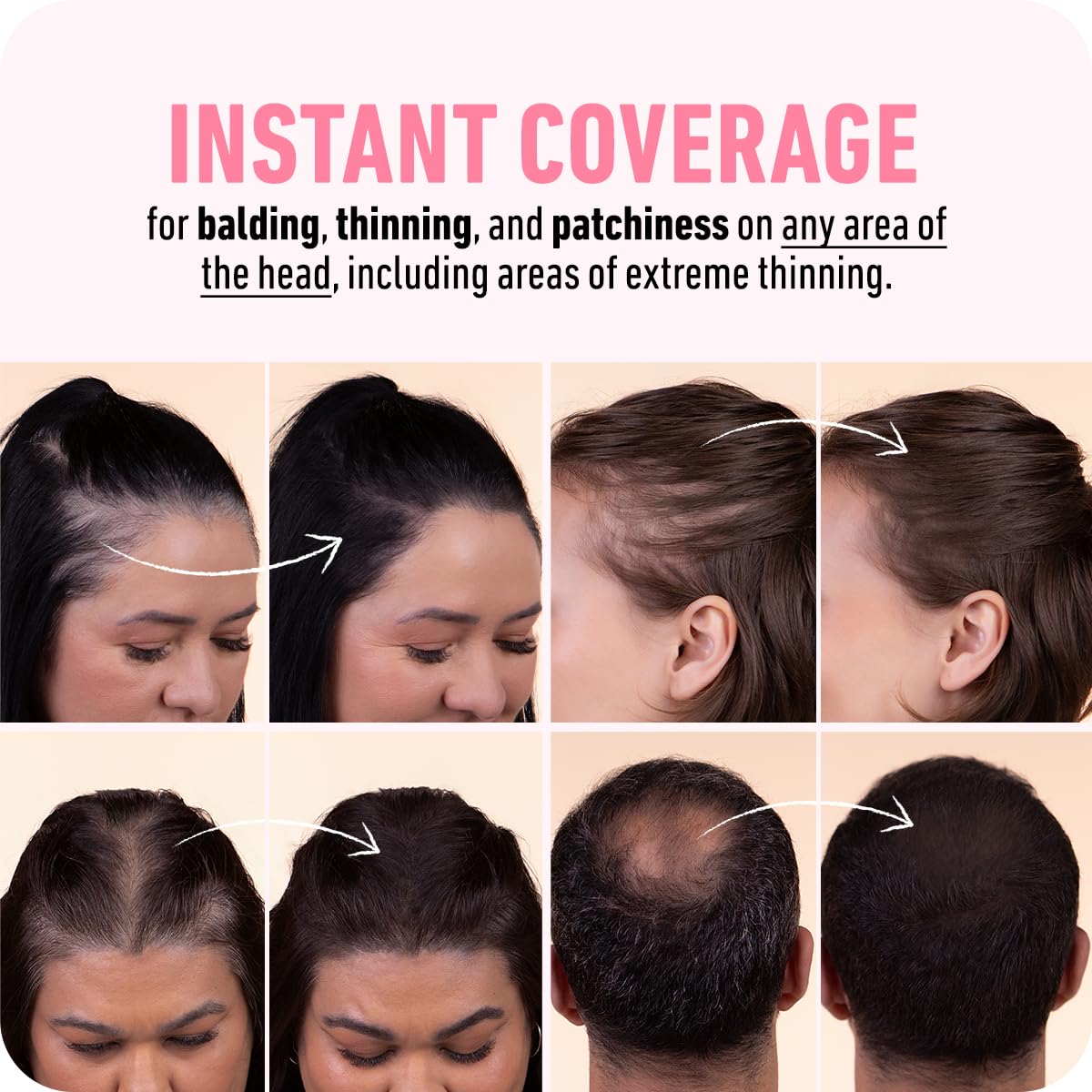 BOLDIFY Hairline Powder - Root Touch Up Hair Color for Gray Coverage - Bald Spot Concealing Hair Powder for Women & Men - 48-Hour Stain-Proof - Light Brown