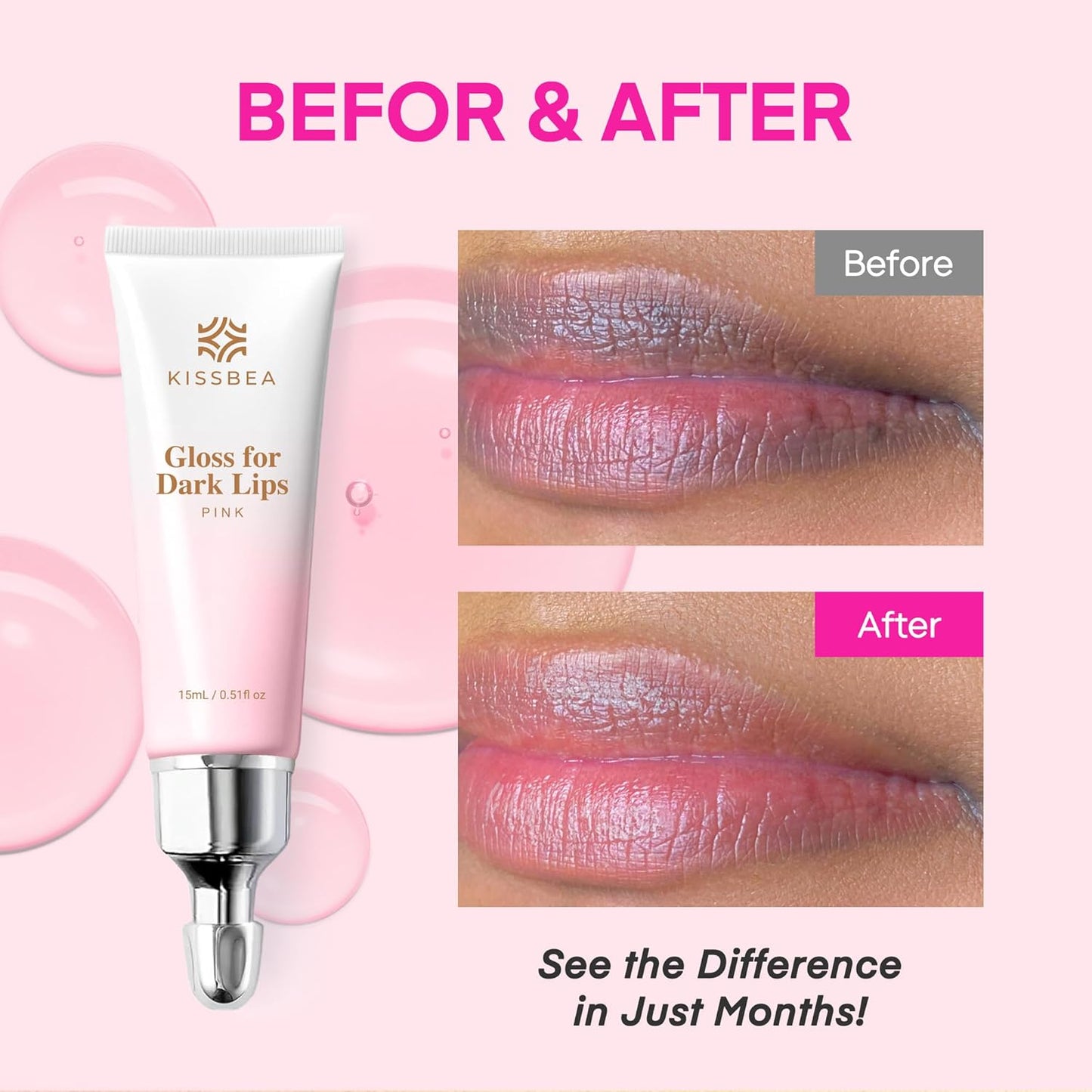 Lip Lightening for Dark Lips: for Smokers, Dry or Uneven-Toned Lips – Restores Natural Look & Moisture with VC, Lemon Peel & Licorice – Refreshing Mint Scent – 15 mL