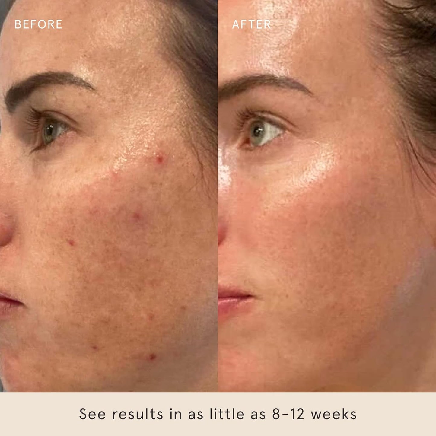 Barefaced Serum Duo - RetinAL & Liquid Gold to Hydrate, Even Skin Tone, & Reduce Signs of Aging