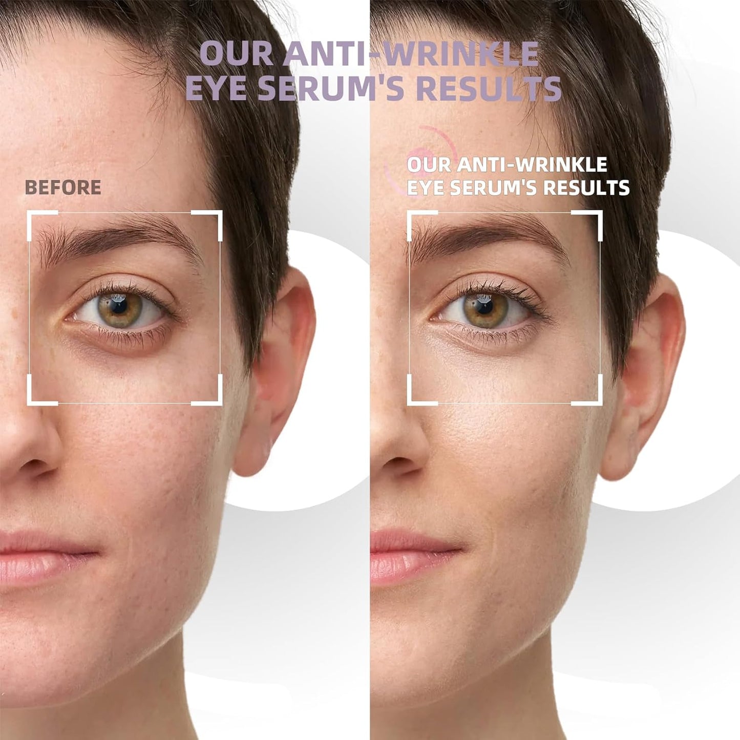 5% Caffeine Eye Cream & Under Eye Serum for Dark Circles and Puffiness Eye Care Eye Roller Serum with 360° Massage Ball Eye Treatment Serum Under Eye Roller Cream for Women Reduce Wrinkles Fine Lines