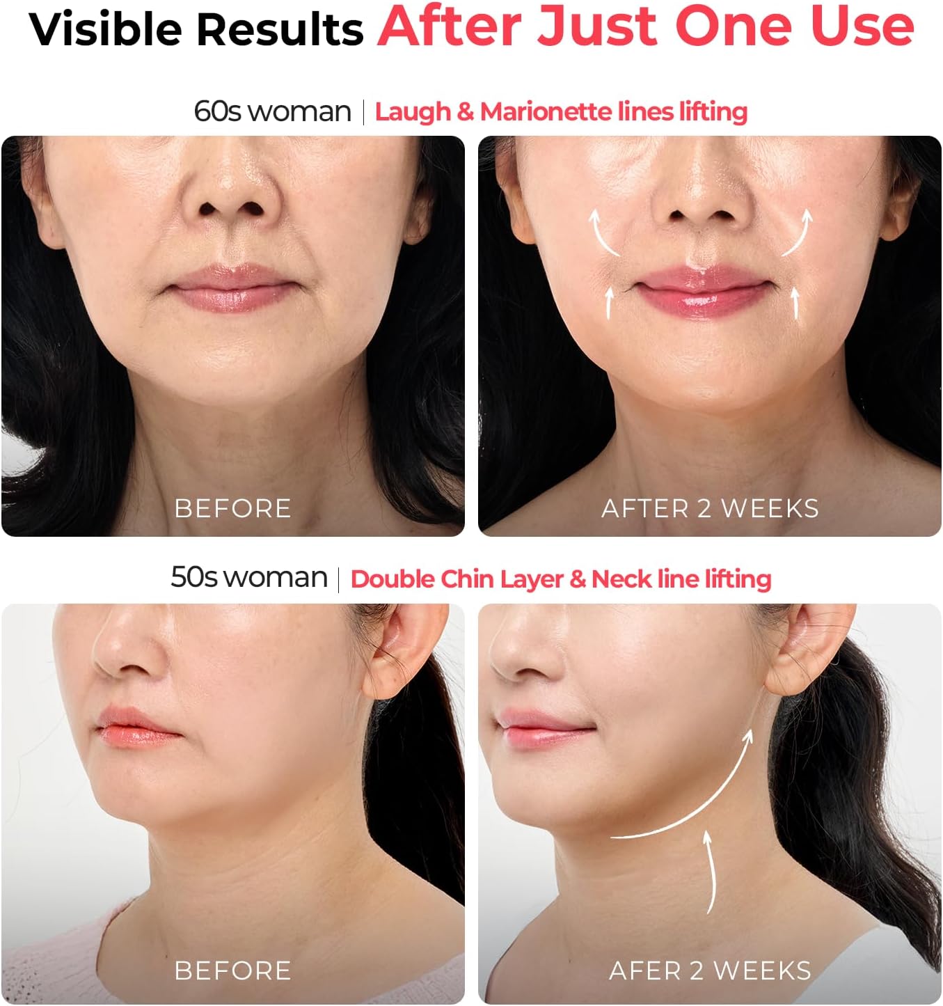 AALOK Ultra Olla Premium Beauty Massager - Korean Skin Care