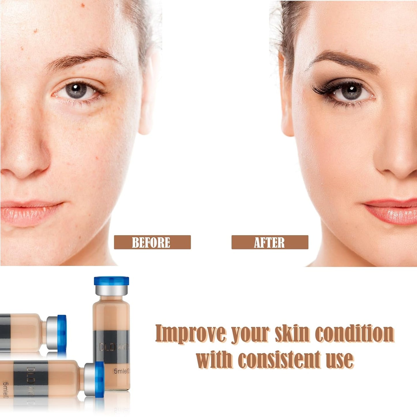 BB Facial Glow Starter Kit Facial Pigment Serum Treatment Kit,Anti-Aging Serum Pigments Set for Micro-needling Skin Treatment 10 Vials 5ml Hyaluronic Acid Ampoule foundation Essence Skin