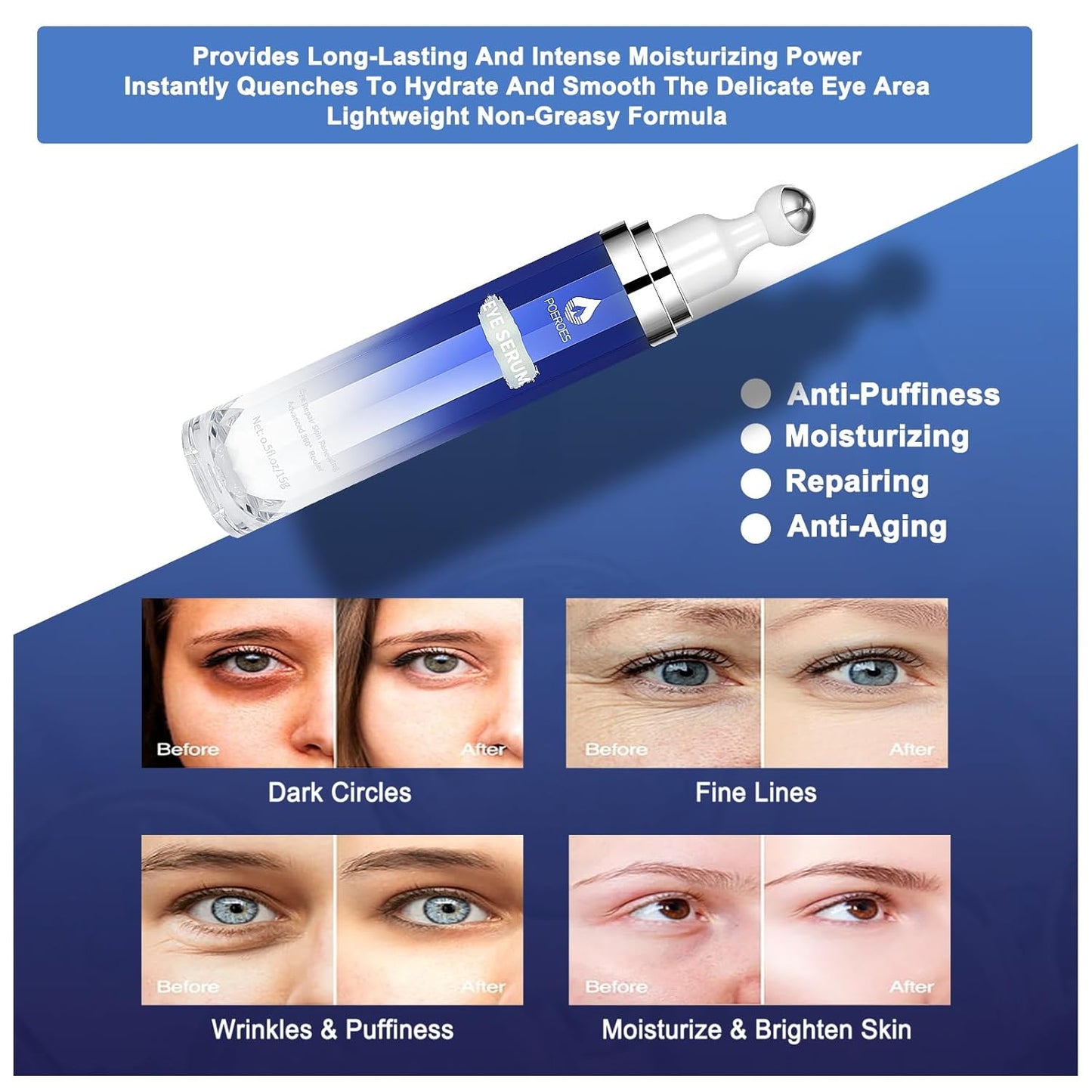 Eye Serum with 8% Caffeine 8% Retinol Hyaluronic Acid Niacinamide peptides for Puffy Eye Bags Fine Lines Dark Circles Wrinkles, Under Eye Cream with 360° Eye Roller Massage Ball, 0.5 fl. oz