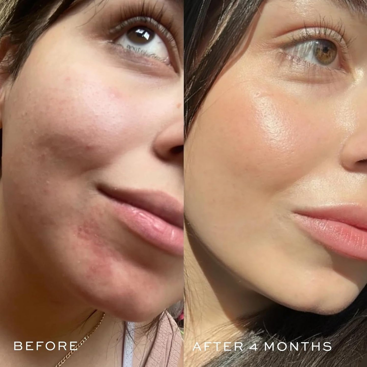 DIME Beauty Blue Facial Oil, 1 oz / 30 mL - Blemish Spot Treatment with Blue Tansy, Black Cumin Seed, Rosehip, and Grapeseed Oils