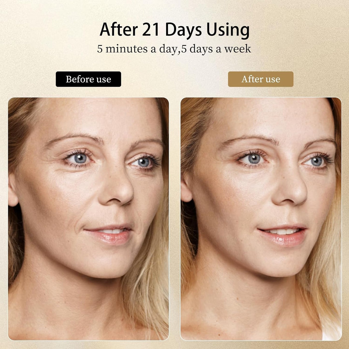 8 Modes&3 Color Facial-Massager-Device(Gold)