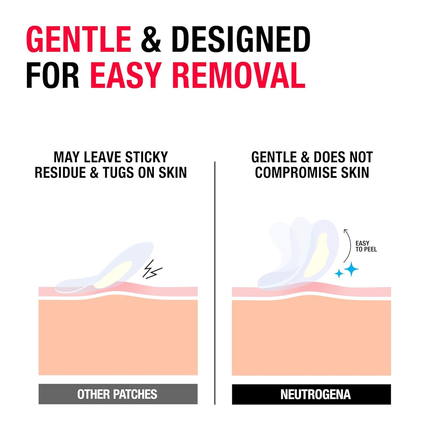 Neutrogena Sensitive Skin Blemish Patches, Acne Patches for Sensitive Skin, Hydrocolloid Treatment Visibly Shrinks Pimples Overnight, 2 Sizes, 30 Count