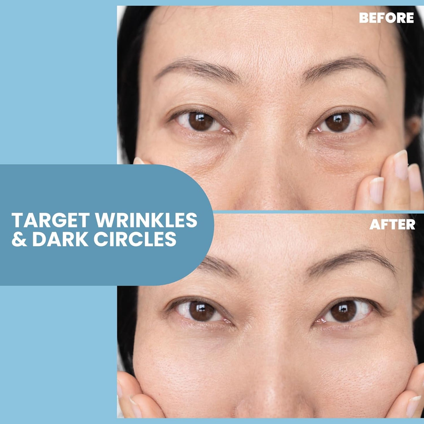 Eva Naturals Eye Gel for Dark Circles, Bags & Puffiness – Anti-Aging Serum with Peptides, Hyaluronic Acid & Botanicals – Firming Under Eye Treatment for Wrinkles, Fine Lines & Tired Skin – 1 oz