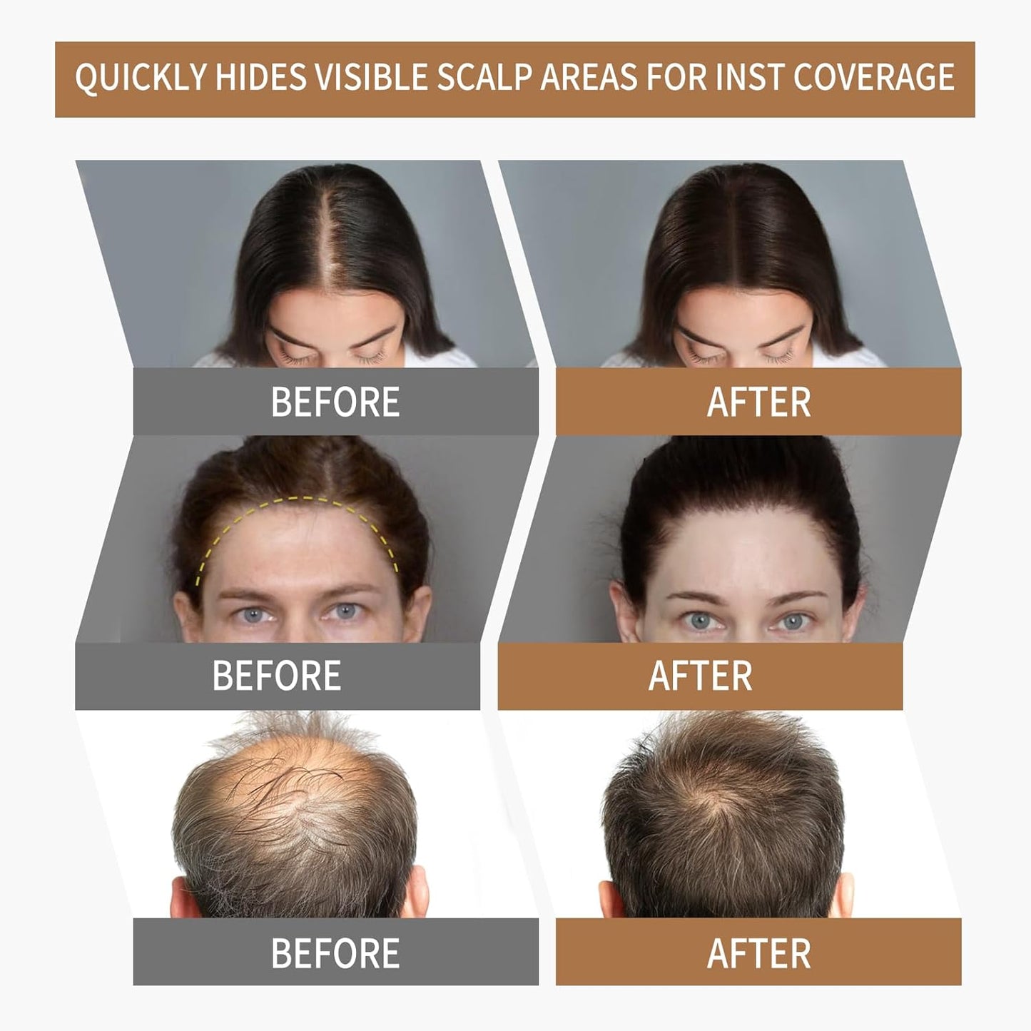 Sevich Hairline Powder 2.0，Instantly Conceals Hair Loss, Root Touch up Powder, Hair Shadow Toppers for Women & Men Thinning Gray Hair, Windproof & Sweatproof, 48H Makeup Lasting, Black