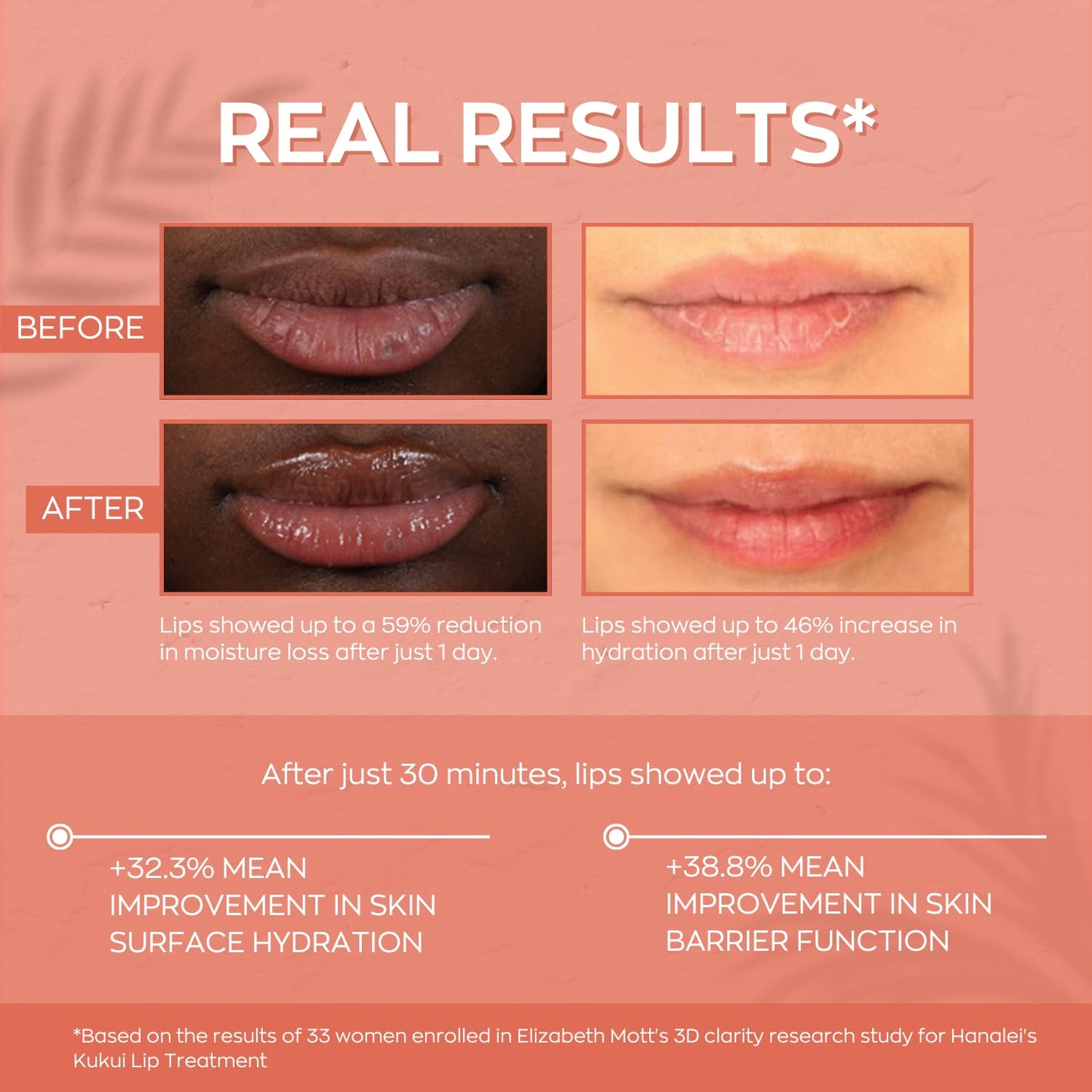 Hanalei Hydrating Lip Treatment Balm – Cruelty-Free, Paraben-Free Moisturizer for Severely Dry, Chapped Lips – Kukui Oil, Shea Butter & Grapeseed Oil –Rose Tint, Travel-Size 3-Pack (5g X 3)