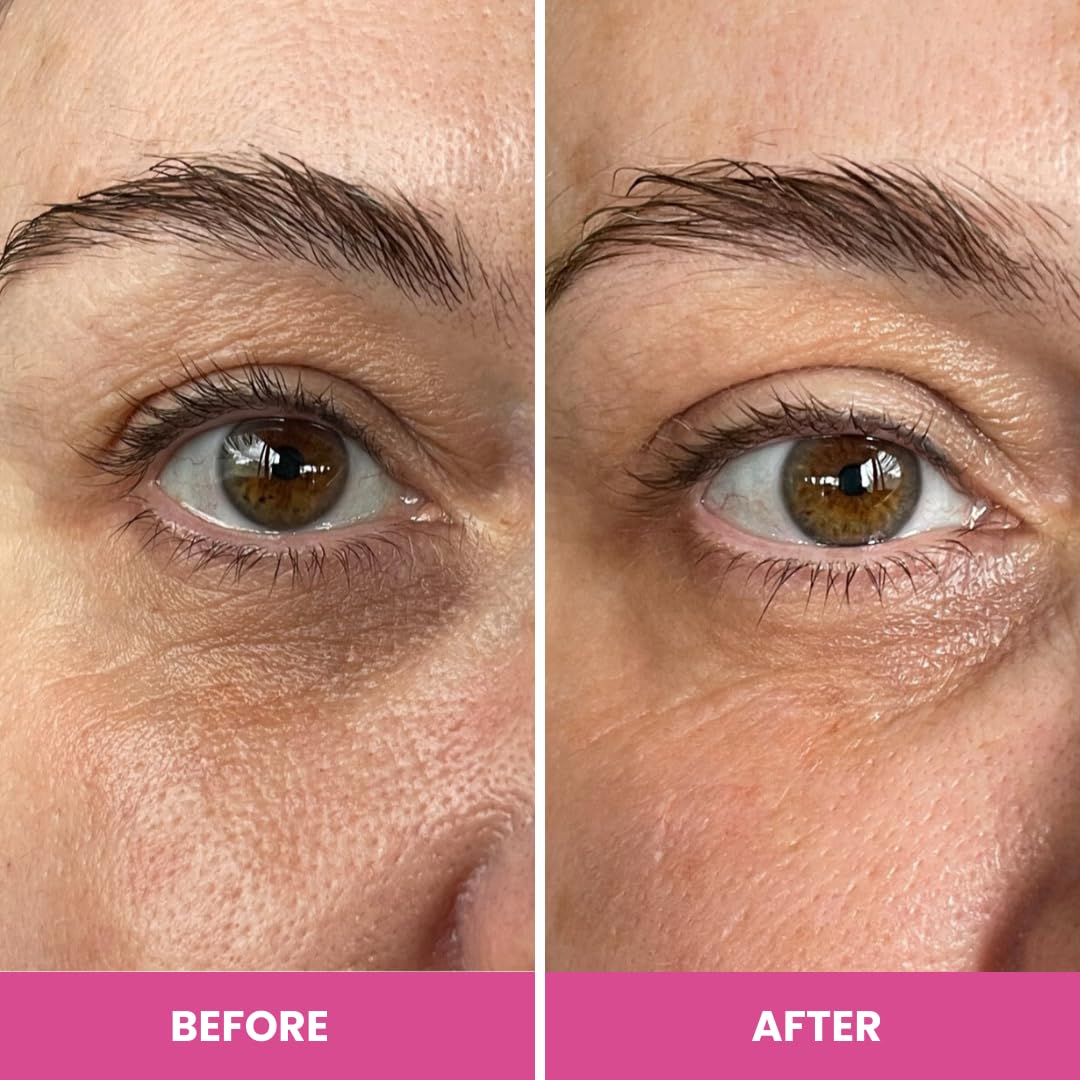 PrimeEyes Hydrate Under Eye Cream for Mature Women – Hydrating Eye Cream for Dark Circles and Wrinkle Repair – Soft, Glowing & Healthy Under Eyes