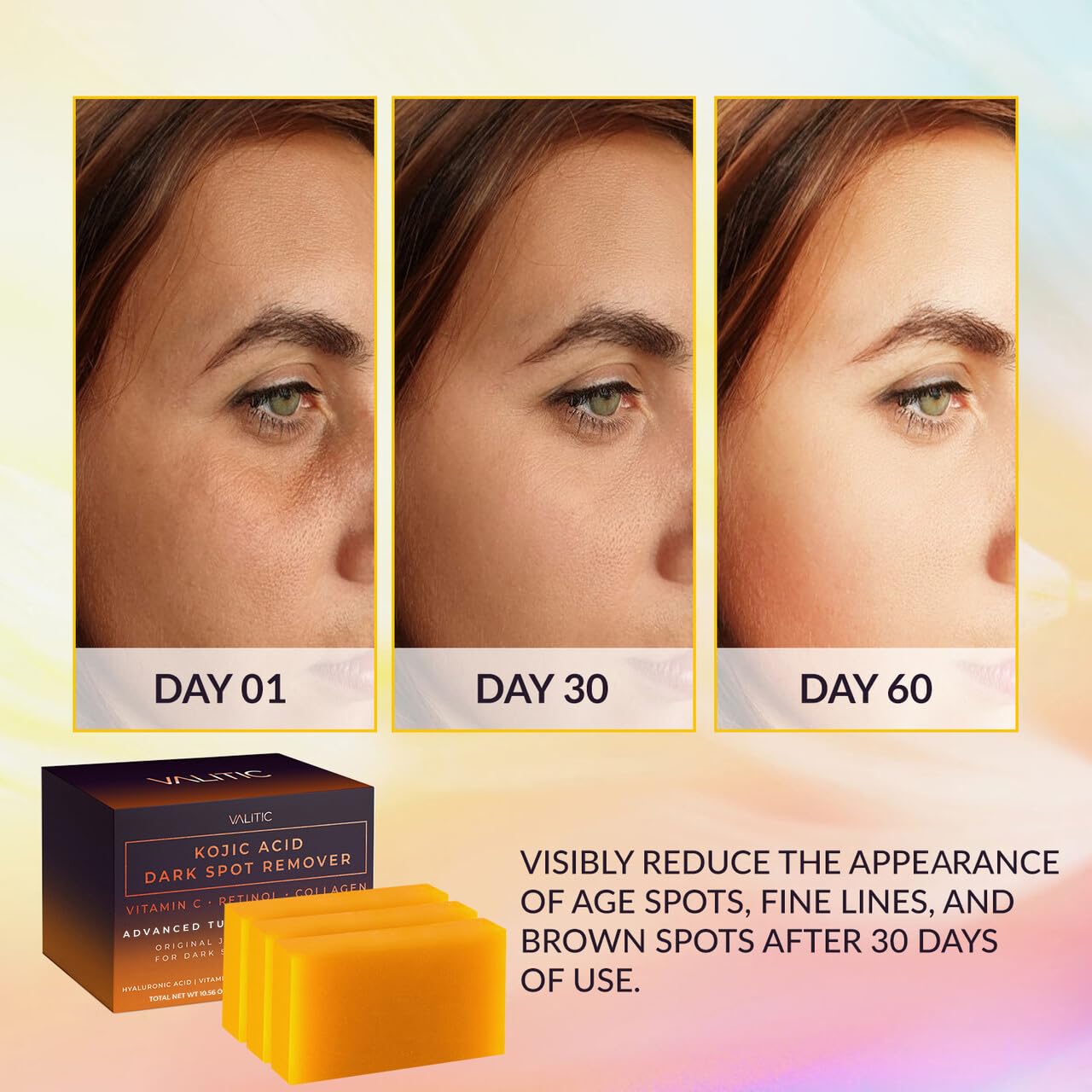 VALITIC Kojic Acid Dark Spot Remover Soap Bars with Vitamin C, Retinol, Collagen, Turmeric - Original Japanese Complex Infused with Hyaluronic Acid, Vitamin E, Shea Butter, Castile Olive Oil (3 Pack)