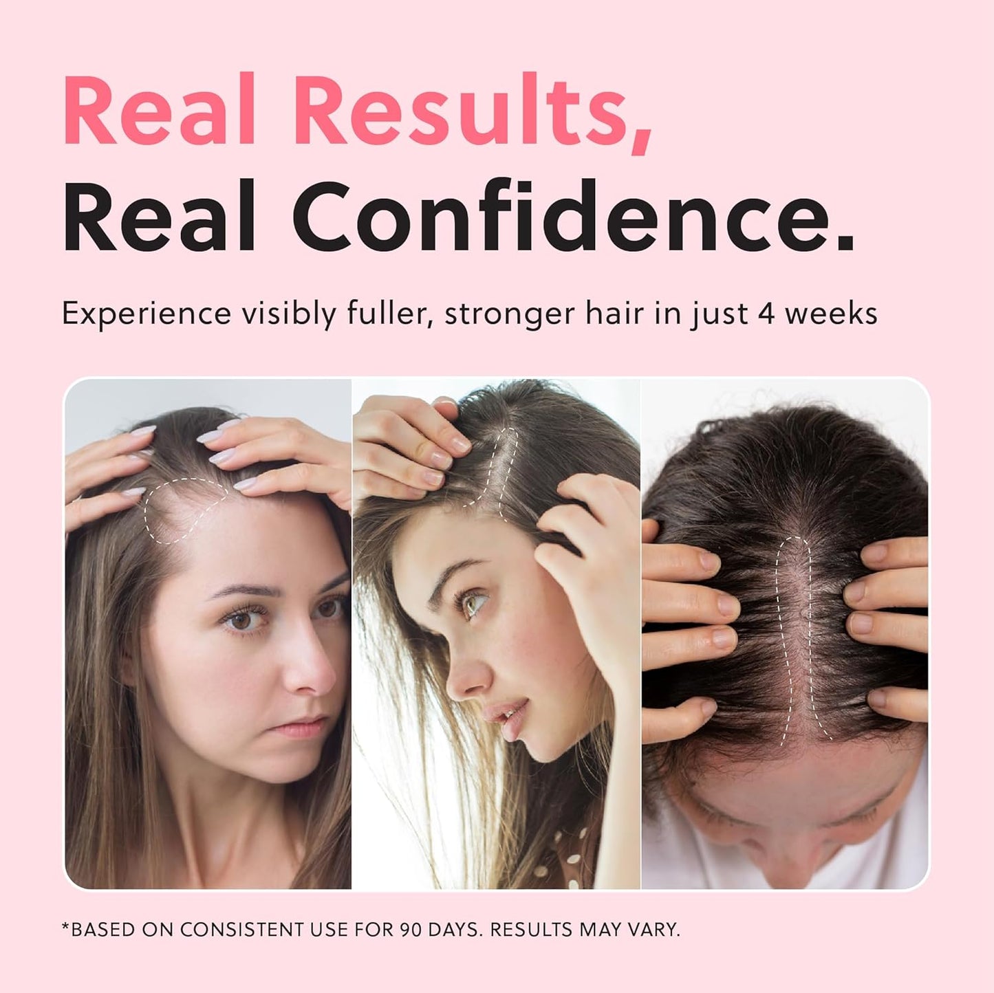 ForHair Advanced Hair Growth Serum for Scalp – Strengthens, Thickens & Accelerates Hair Growth- Non-Greasy, Hormone-Free, Fast-Absorbing Formula – Fights Hair Thinning & Hair Loss – 50ml