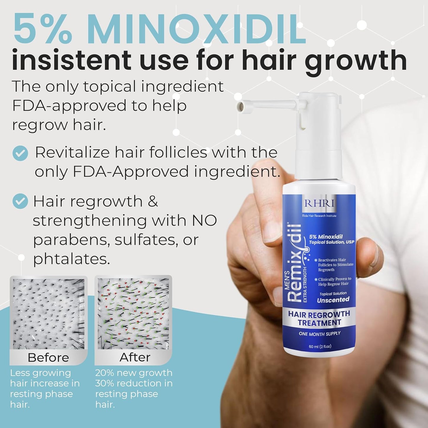 Minoxidil for Men | 5% Minoxidil Hair Regrowth Treatment | Unscented, Clinically Proven for Thinning Hair Regrowth & Follicle Reactivation | Hair Loss Treatments For Men- 60 ml