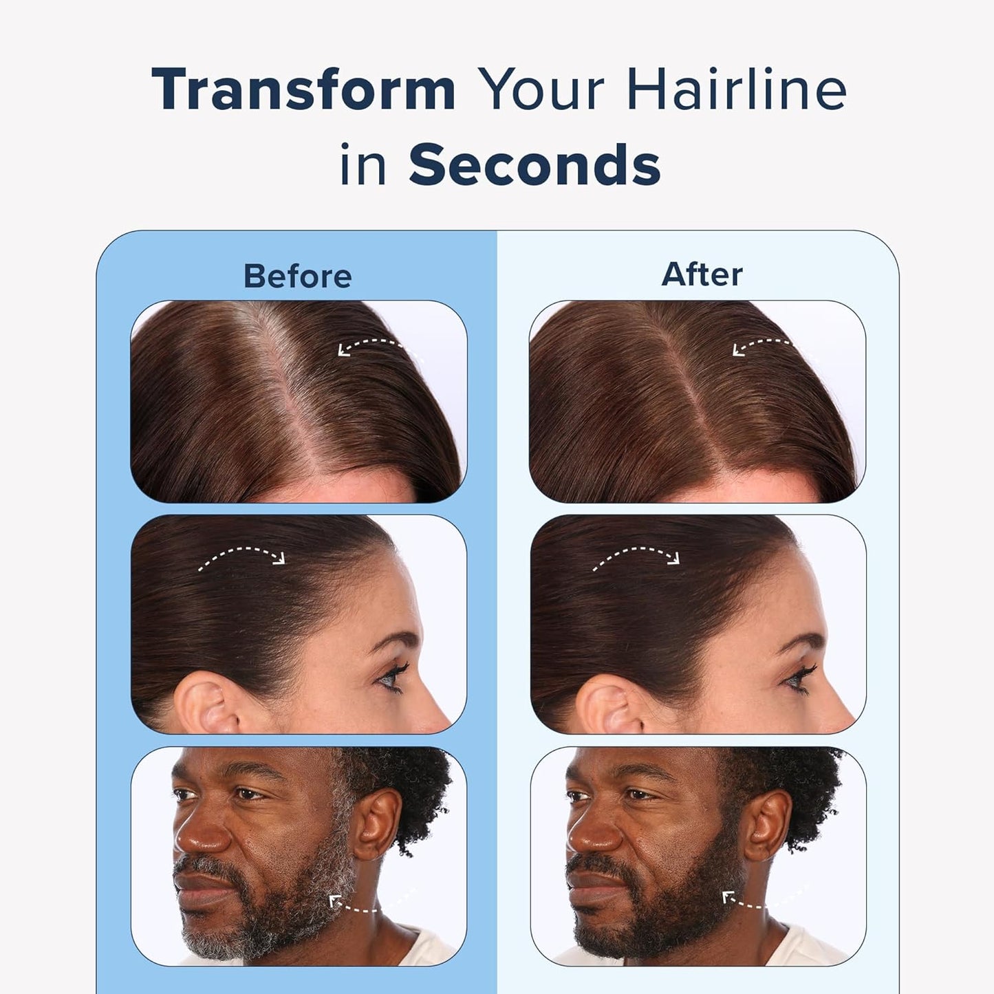 TRUHAIR Jumbo Color & Conceal Waterproof Root Touch Up Hair Color Concealer - Hair Cover up for Gray Coverage and Hairline Filling - 11 Hair Colors Available (Red)