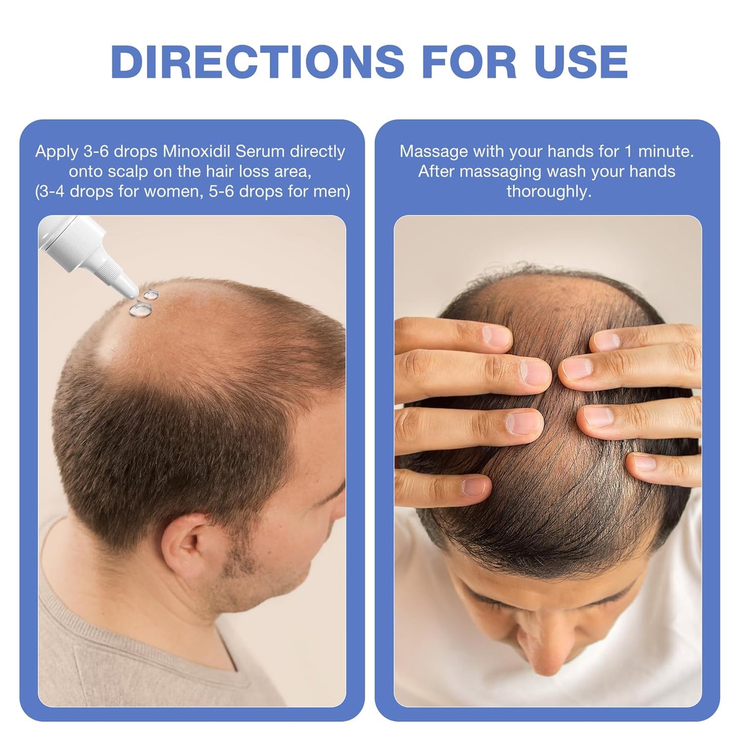 5% Minoxidil for Men Hair Growth Serum - Minoxidil for Women Serum with Biotin for Thicker & Healthier, Topical Minoxidil for Men Restore Fuller Beard