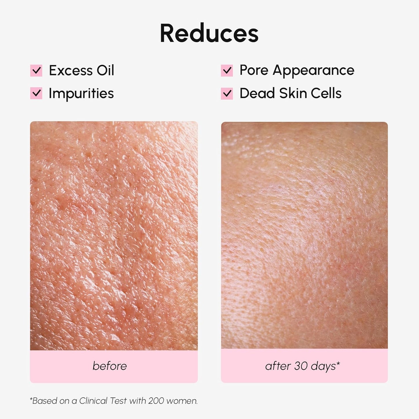 MAREE Pore Minimizer for Face Toner – Witch Hazel Toner with Niacinamide & Marine Collagen – Gentle Exfoliating Oil Control Facial Toner for Women – BHA Liquid Exfoliant – Alcohol Free Tonico Facial