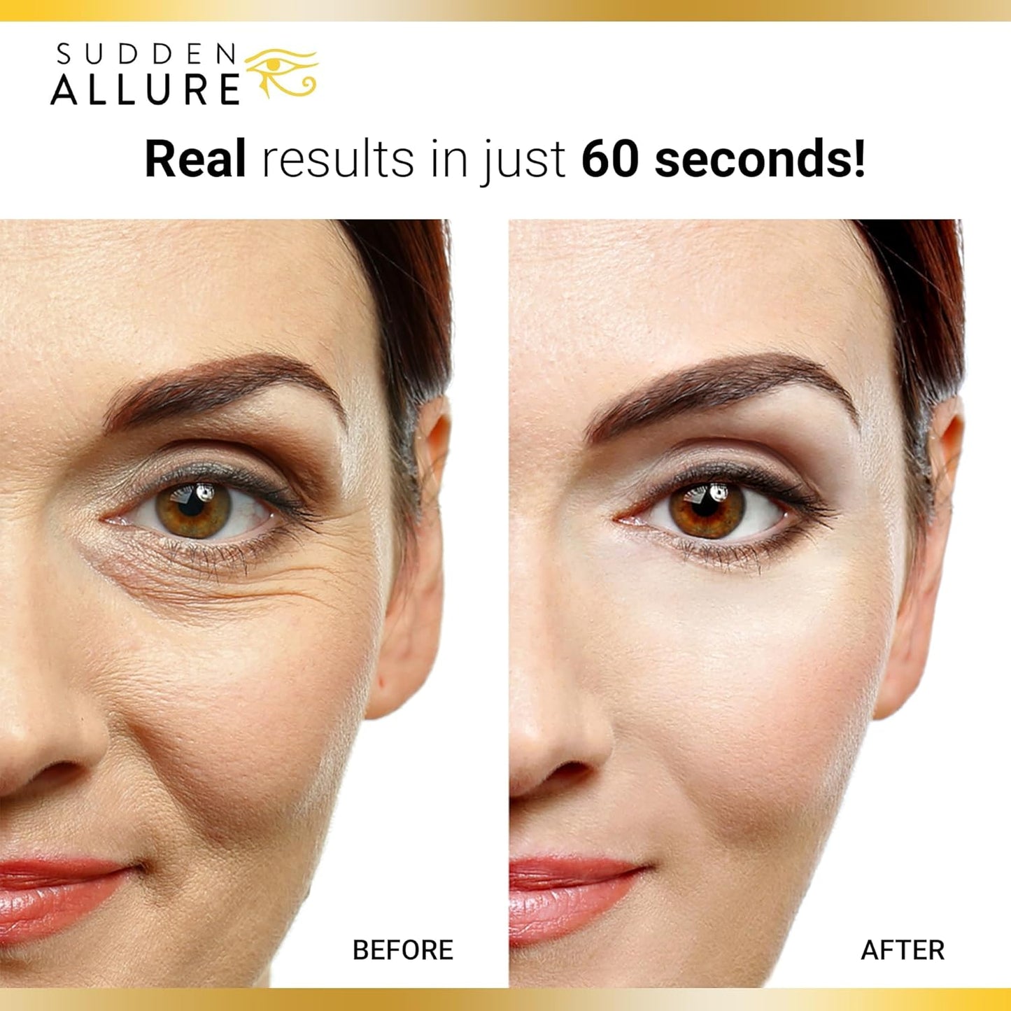 Sudden Allure Instant Under Eye Treatment Serum – Erase Under Eye Bags, Dark Circles, Wrinkles & Lift Sagging Eyes - Instantly Tighten & Firm - Reduce Eye Bags & Crows Feet | Made in USA (10 ml, 3pk)