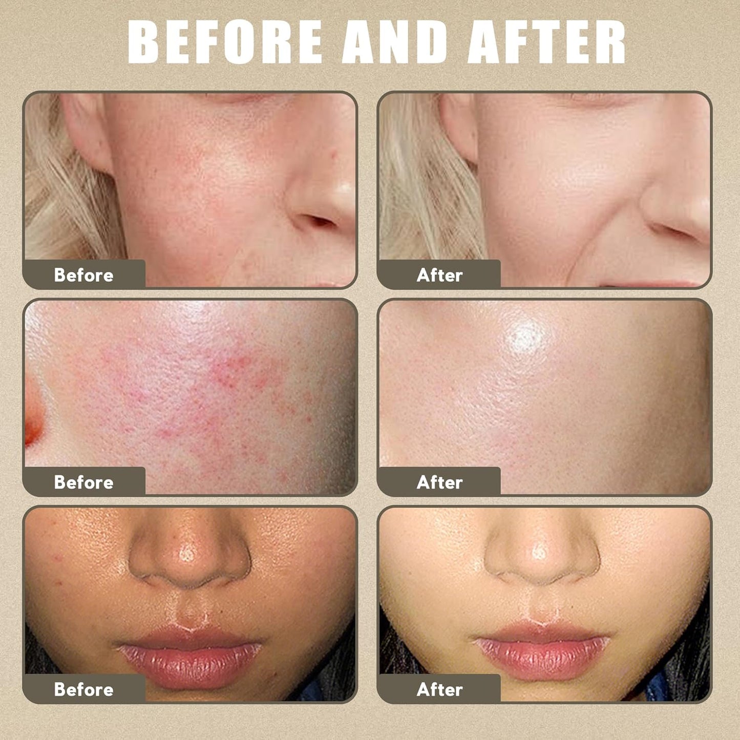 Beef Tallow Sunscreen for Face Body,Tallow Sunscreen SPF 50 Water-Resistant for Summer Outdoor Travel 3.52 OZ