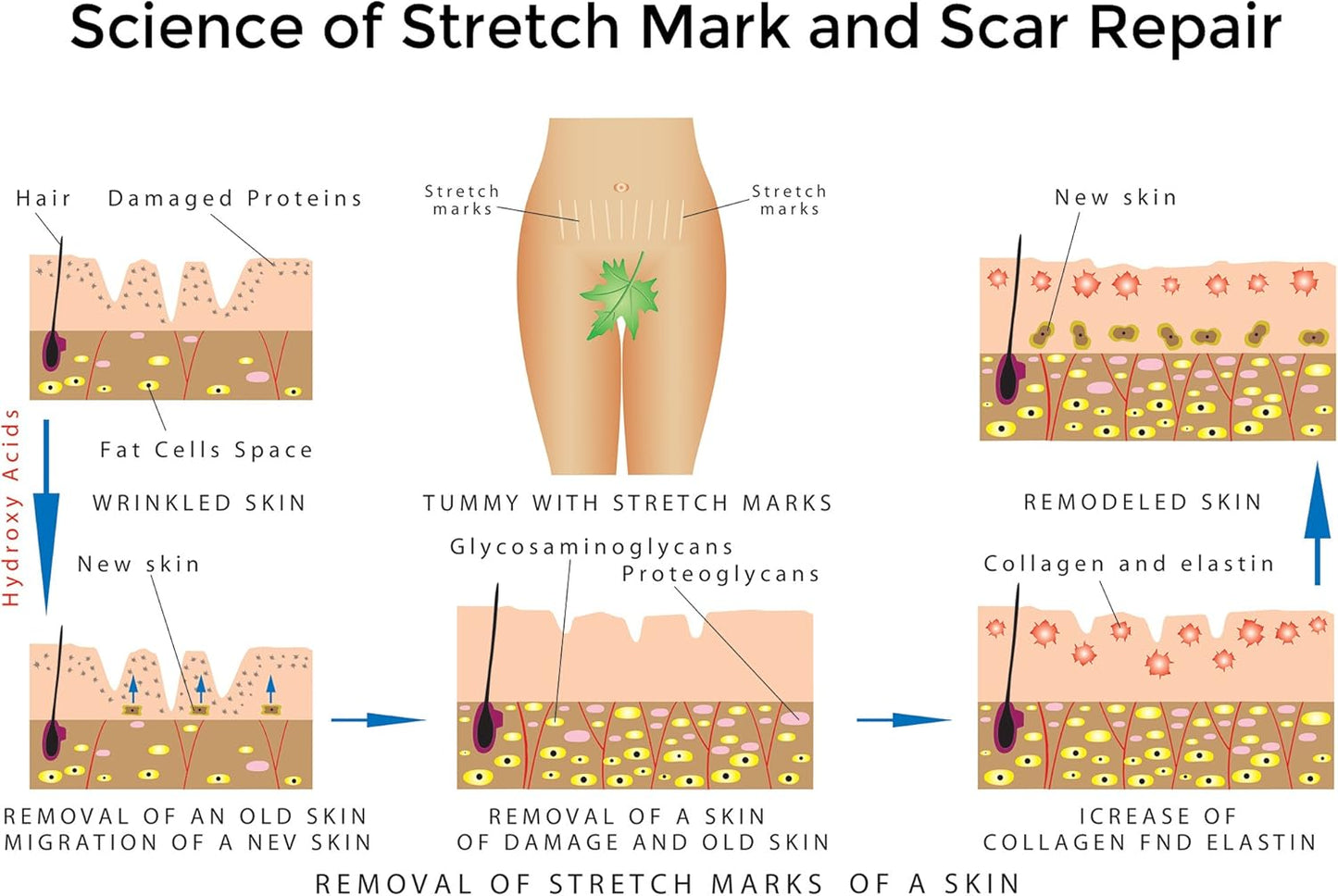 Best Stretch Marks Cream Prevent & Reduce Marks Reduce Pregnancy Stretch Marks Highly Concentrated Cream includes $29 Scar Reducing Guide