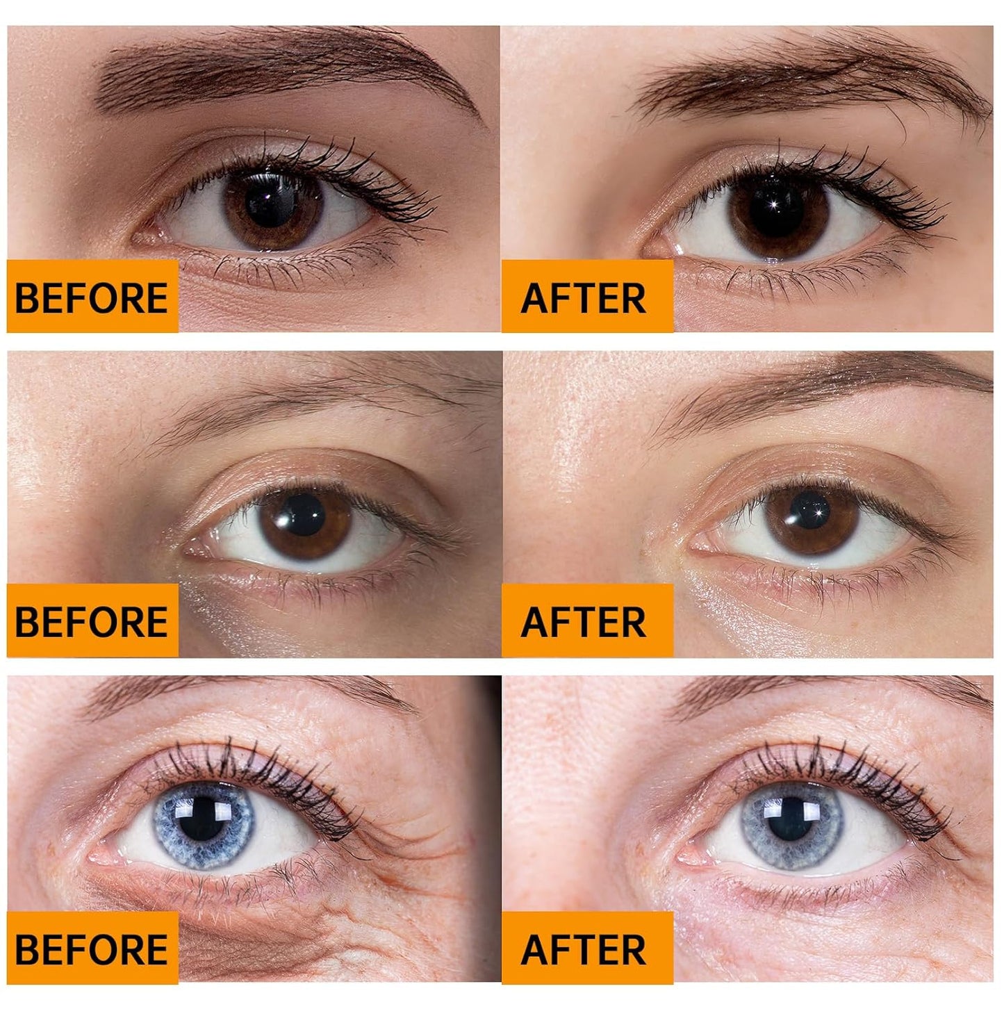 Caffeine Solution 5% + EGCG, Caffeine Eye Serum For Face, 30 ML/ 1 PCS Moisturizing Under Eye Solution For Reduces Dark Circles & Puffiness.