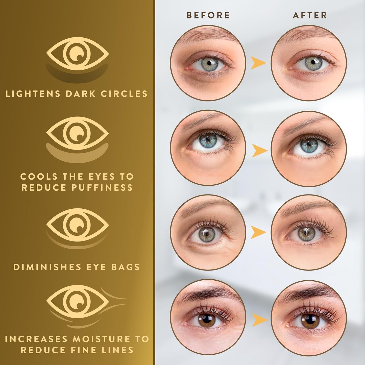 PatchRx 24K Gold Under Eye Patches for Puffy Eyes and Dark Circles with Pure Collagen, Eye Gel Pad Masks for Reducing Eye Bags, Puffy Dark Circles, Wrinkles, and Fine Lines- 36 Pairs