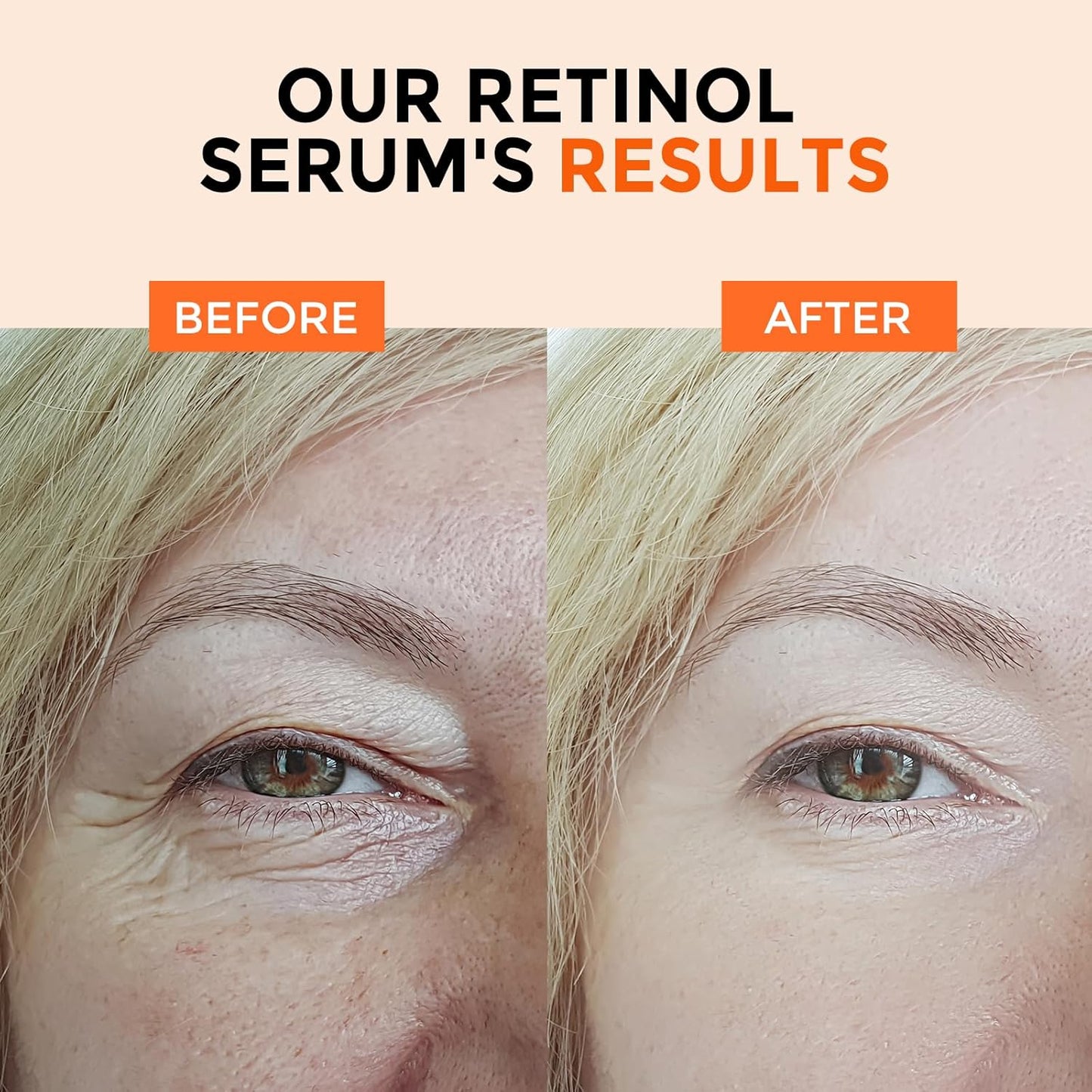 Retinol Serum for Face 2.5%, B5 Resurfacing Retinol Serum with Vitamin C, Vitamin E, Hyaluronic Acid, Niacinamide, Peptide for Anti-Aging, Wrinkle Smoothing, Dark Spot Corrector, Brighten Dullness