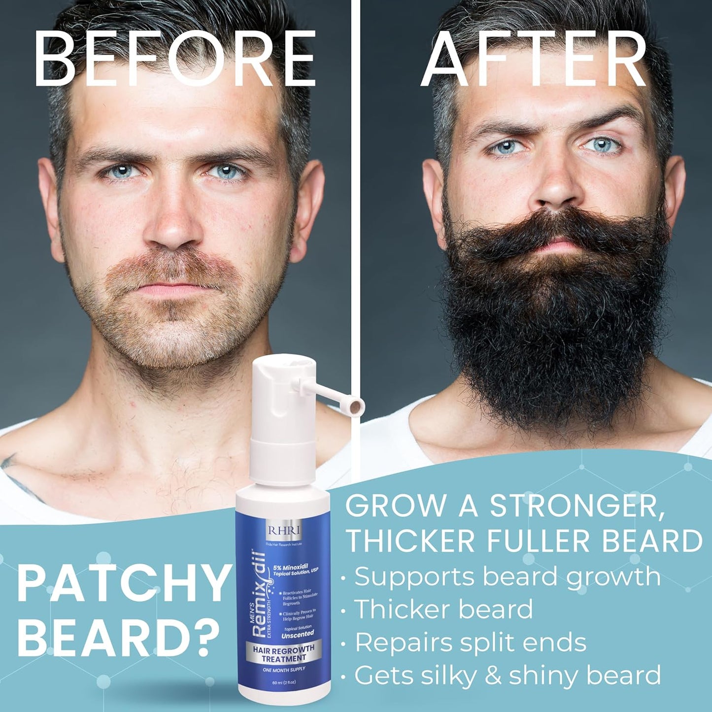 Minoxidil for Men | 5% Minoxidil Hair Regrowth Treatment | Unscented, Clinically Proven for Thinning Hair Regrowth & Follicle Reactivation | Hair Loss Treatments For Men- 60 ml